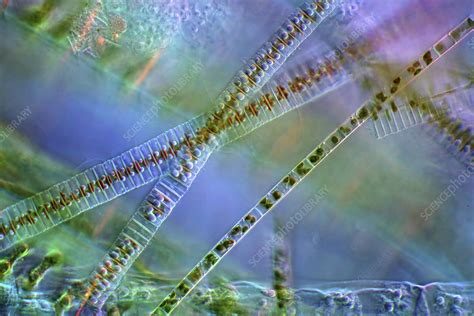Fragilaria Diatoms And Filamentous Algae Micrograph Stock Image