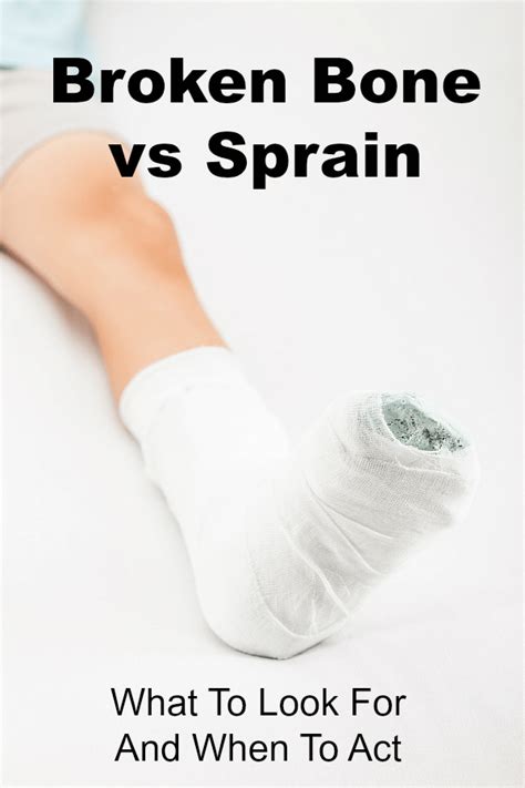 Types of biopsy procedures used to diagnose bone cancer include: Broken Bone Vs Sprain: What To Look For And When To Act