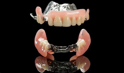 Removable Partial Denture