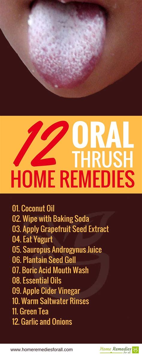 12 Natural Remedies For Oral Thrush Oral Thrush Remedies Natural Sleep Remedies Natural