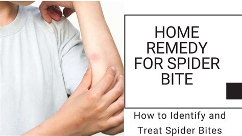Home Remedy For Spider Bite How To Identify And Treat Spider Bites