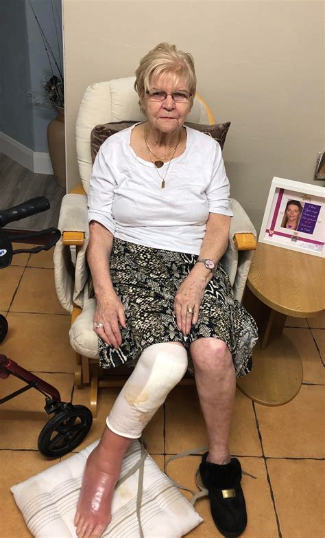 Over €8000 Raised To Fund 70 Year Old Newbridge Womans Leg Amputation