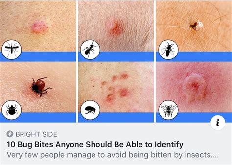 Arm Identifying Bed Bug Bites On Humans 44mamawsfinishedcrossstitchitems
