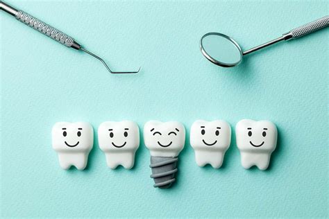What Are Dental Implants Dental Implant Procedure Tx