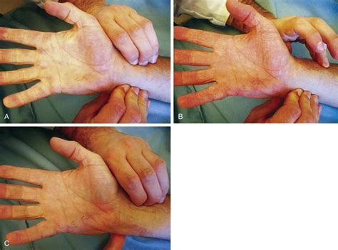 Hand And Wrist Diagnosis And Decision Making Musculoskeletal Key