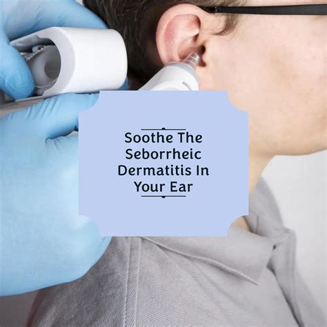 Seborrheic Dermatitis Inside Ear Treatment Effective Solutions