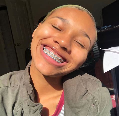 The Best Best Color Braces For Brown Skin References