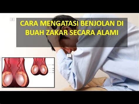 CARA MENGATASI BENJOLAN DI BUAH ZAKAR SECARA ALAMI - YouTube