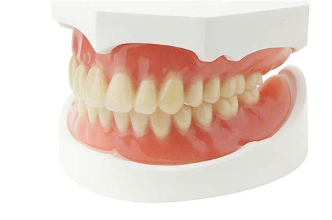 Royalty Free Upper Denture Pictures Images And Stock Photos Istock