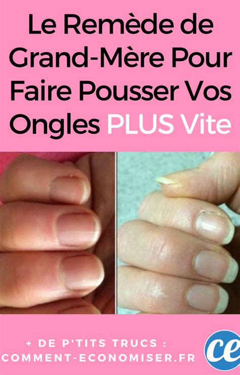 How To Fix A Broken Nail In 5 Minutes Artofit