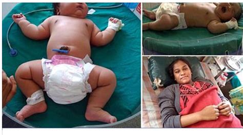 Indian Woman Gives Birth To Heaviest Baby In The World See Photos Welcome To Tmzupdate S