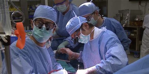 cleveland clinic performs first purely laparoscopic living donor surgery for liver transplant