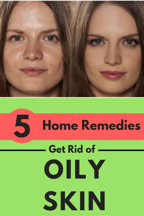 Oily Face Can Be Easily Dealt With These 5 Super Effective Home Remedies Skincare Skin