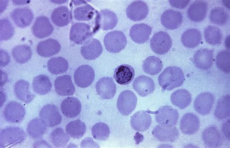 Plasmodium Malariae Trophozoite