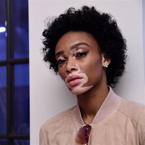 How Much Do You Know About Winnie Harlow Albino Black Girl Glamour