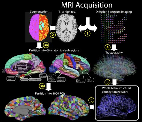 Cerebral Cortex And Its Millions Of Neural Fibers Gets A Map Science