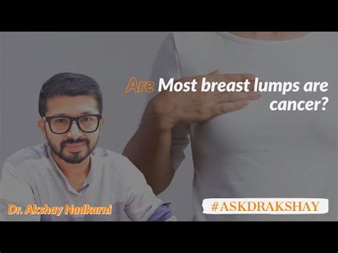 This type of lump may be a sign of breast cancer or a benign breast condition (such as a cyst or fibroadenoma). Are most breast lumps cancer? - YouTube