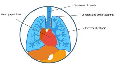 These cases are often misdiagnosed as influenza or pneumonia in the earlier stages. Mesothelioma Symptoms - Early Warning Signs of Abestos Cancer