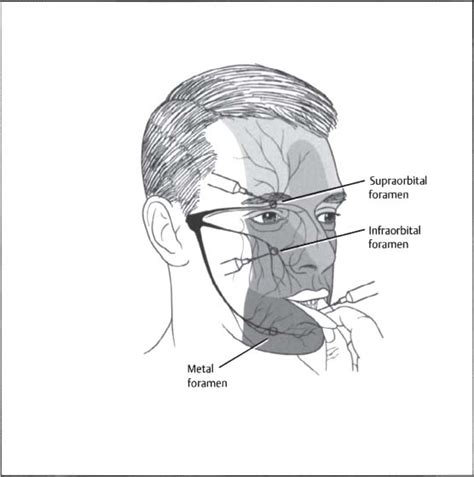 Facial Lacerations Plastic Surgery Key