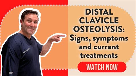 Distal Clavicle Osteolysis Signs Symptoms And Current Treatments