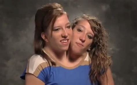 The Dynamic Biz News Abby And Brittany Hensel Conjoined 22 Year Old