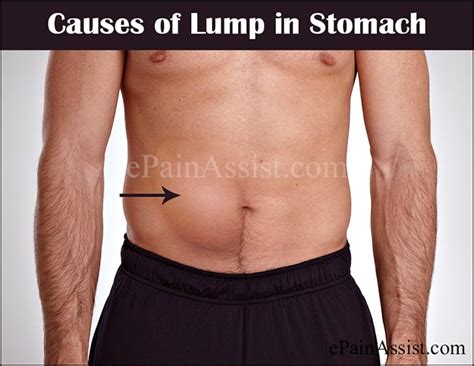 Hard Lump In Stomach
