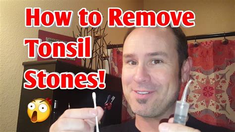 How To Easily Remove Tonsil Stones 💎💉 Youtube