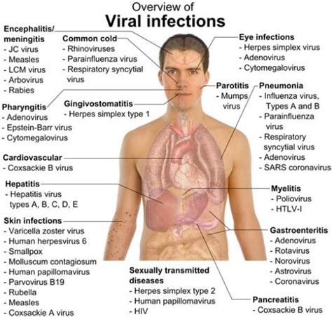 Infectious Diseases Viral Fungal And Parasitic Disease Overview
