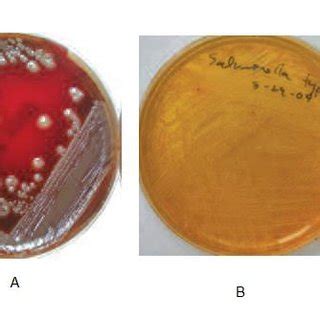 I hope this video will helpful for your. A.) Escherichia Coli on sheep blood agar B.) Salmonella ...