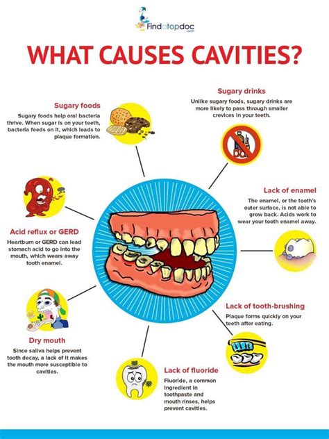 What Are Cavities What Causes Cavities Infographic