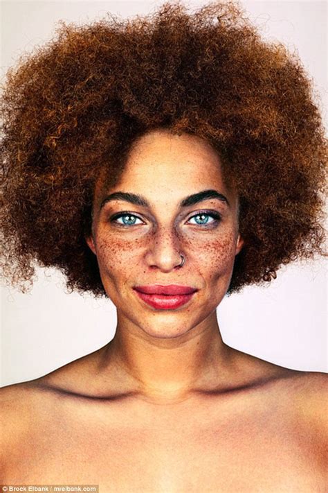 Photographer Brock Elbank Captures Men And Women Covered In Freckles