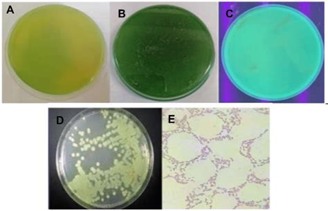 Colony Morphology Of Pseudomonas Fluorescens After 24 Hrs Growth On