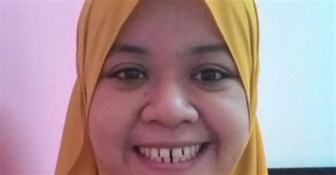 get quote call now get directions. Braces murah di Klinik Pergigian Aina Kajang | Its Me Jaja
