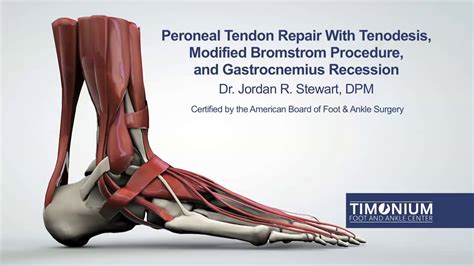 Peroneal Tendon Repair With Tenodesis Modified Bromstrom Procedure And