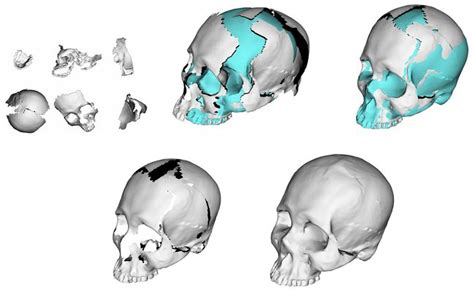 Computational Forensics Digital Skull Restoration And Facial
