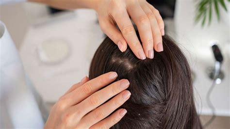 What Are The Causes Of Scalp Acne Know Simple Preventive Measures To