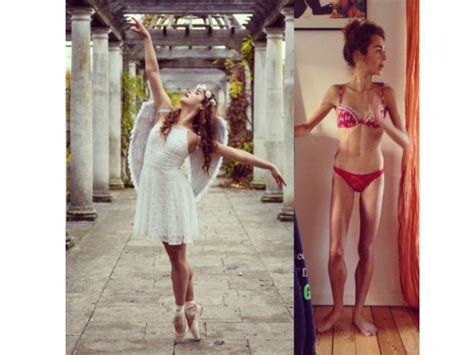 Margherita Barbieri Who Fought Anorexia Model Who Fought Anorexia Anorexia Victim