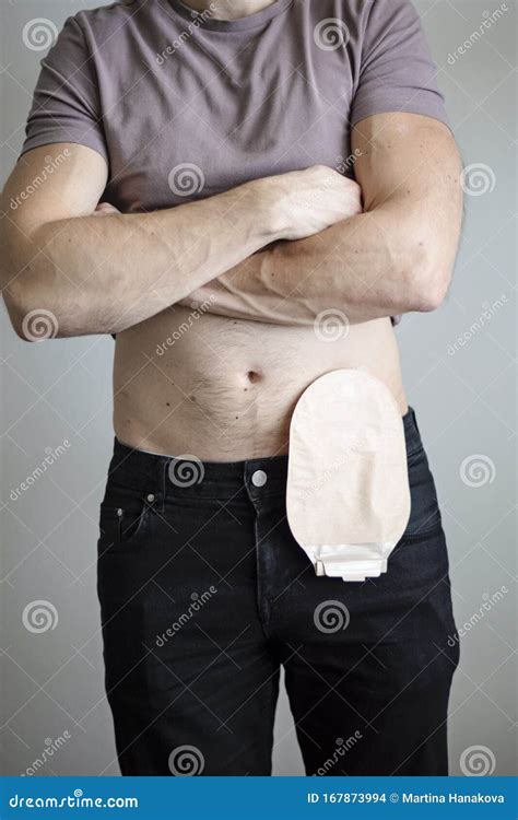 Front View On Colostomy Bag Attached To Man Patient Medical Theme