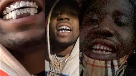 Rapper Rashawn YFN Lucci Bennett Removes Gold Grill Teeth Are