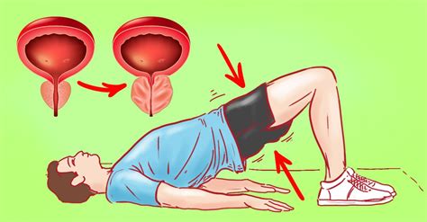 Exercice Pour La Prostatite Gymnastique Pour Linflammation De La Prostate Prostero