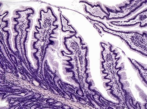 Intestinal Mucosa LM Stock Image C030 5112 Science Photo Library