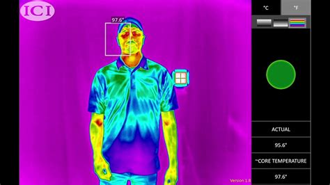 Benefits Of Thermal Cameras For Measuring Elevated Body Temperatures
