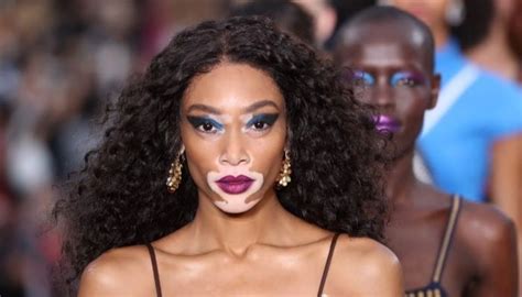 Winnie Harlow Stuns In Bold Nearly Sheer Gold Dress At Victorias
