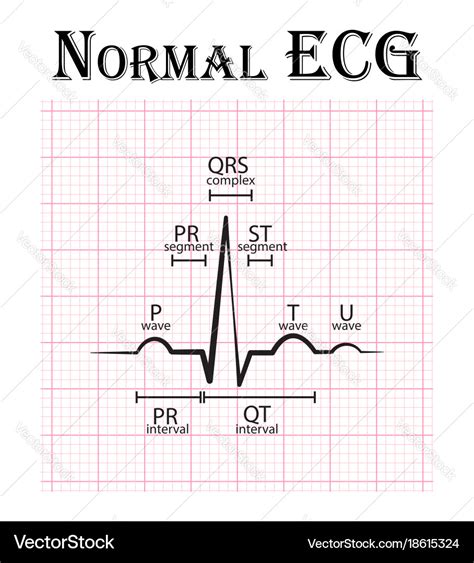 Normal Electrocardiogram Royalty Free Vector Image