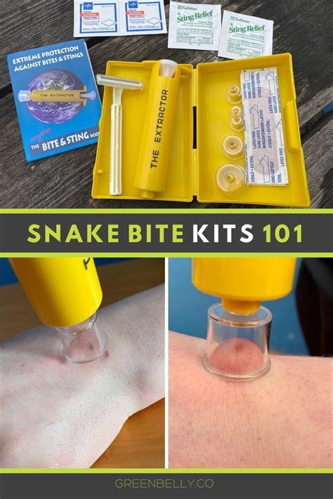 Snake Bite Kits Do They Really Work Snake Bites Snake Snake Venom