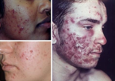 Maybe you would like to learn more about one of these? Hindari Pencuci Muka Beralkohol