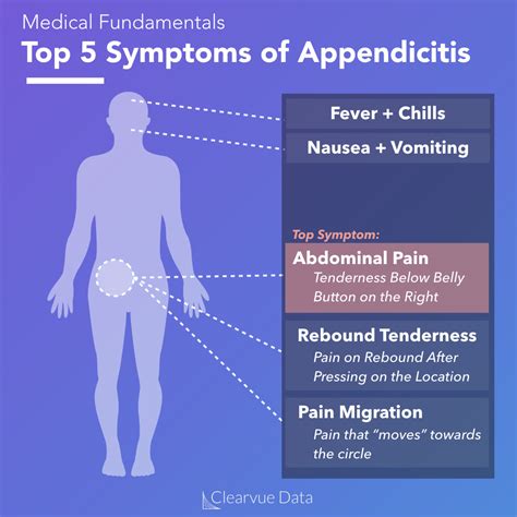 Appendicitis Types Signs And Symptoms Causes Risk Fac