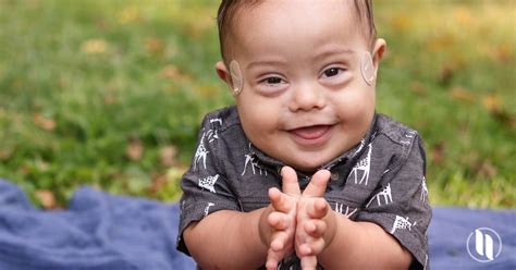 In the u.s., down syndrome is the least funded major genetic condition by our national institutes of health despite being the most frequent chromosomal disorder. Meet Emerson: Pulmonary Hypertension Was No Problem for ...