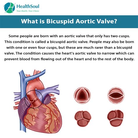 Is Bicuspid Aortic Valve A Disability