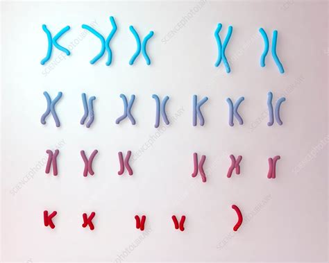 Turner S Syndrome Karyotype Illustration Stock Image F